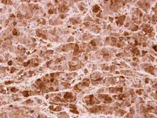 Anti-PRMT5 antibody [N1C1] used in IHC (Paraffin sections) (IHC-P). GTX116004