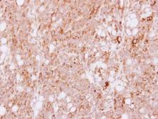 Anti-MAP4K4 antibody used in IHC (Paraffin sections) (IHC-P). GTX116008