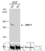 Anti-DNMT1 antibody [N1], N-term used in Western Blot (WB). GTX116011