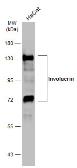 Anti-Involucrin antibody [N1N2], N-term used in Western Blot (WB). GTX116012