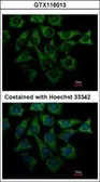 Anti-Loricrin antibody [N1], N-term used in Immunocytochemistry/ Immunofluorescence (ICC/IF). GTX116013