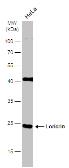 Anti-Loricrin antibody [N1], N-term used in Western Blot (WB). GTX116013