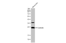 Anti-Loricrin antibody [N1], N-term used in Western Blot (WB). GTX116013