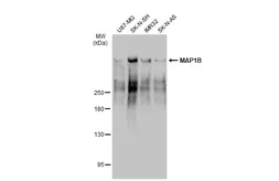 Anti-MAP1B antibody used in Western Blot (WB). GTX116014