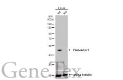 Anti-Presenilin 1 antibody [C1C2], Internal used in Western Blot (WB). GTX116016