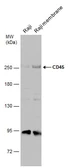 Anti-CD45 antibody used in Western Blot (WB). GTX116018