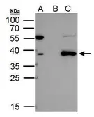 Anti-TAL1 antibody [C2C3], C-term used in Immunoprecipitation (IP). GTX116020
