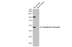 Anti-Endothelin A Receptor antibody [C3], C-term used in Western Blot (WB). GTX116034