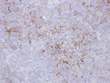 Anti-Endothelin A Receptor antibody [C3], C-term used in IHC (Paraffin sections) (IHC-P). GTX116034