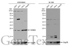 Anti-H-Ras antibody used in Western Blot (WB). GTX116041