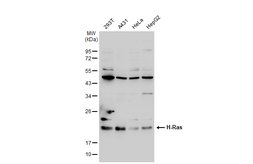 Anti-H-Ras antibody used in Western Blot (WB). GTX116041