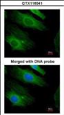 Anti-H-Ras antibody used in Immunocytochemistry/ Immunofluorescence (ICC/IF). GTX116041