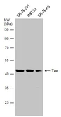 Anti-Tau antibody used in Western Blot (WB). GTX116044
