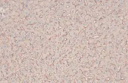 Anti-MRP1 antibody [N1N2], N-term used in IHC (Paraffin sections) (IHC-P). GTX116046