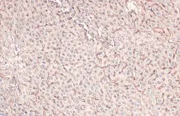 Anti-MRP1 antibody [N1N2], N-term used in IHC (Paraffin sections) (IHC-P). GTX116046