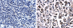 Anti-Progesterone Receptor antibody [N1], N-term used in IHC (Paraffin sections) (IHC-P). GTX116051