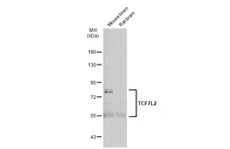 Anti-TCF7L2 antibody used in Western Blot (WB). GTX116056