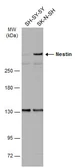 Anti-Nestin antibody used in Western Blot (WB). GTX116066