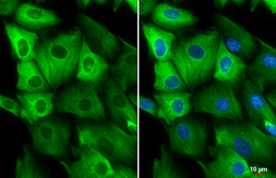 Anti-Nestin antibody used in Immunocytochemistry/ Immunofluorescence (ICC/IF). GTX116066