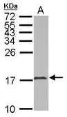 Anti-LC3B antibody [N1C3] used in Western Blot (WB). GTX116080