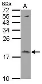 Anti-LC3B antibody [N1C3] used in Western Blot (WB). GTX116080