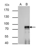 Anti-SOX6 antibody [N1C3] used in Immunoprecipitation (IP). GTX116081