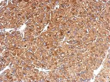 Anti-HLA-E antibody used in IHC (Paraffin sections) (IHC-P). GTX116088