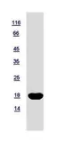 Human nm23-H2 protein, His tag. GTX116091-pro