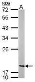 Anti-nm23-H2 antibody used in Western Blot (WB). GTX116091