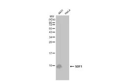 Anti-SDF1 antibody [N1C3] used in Western Blot (WB). GTX116092