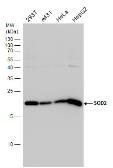 Anti-SOD2 antibody used in Western Blot (WB). GTX116093