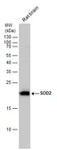 Anti-SOD2 antibody used in Western Blot (WB). GTX116093