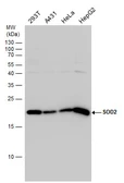 Anti-SOD2 antibody used in Western Blot (WB). GTX116093