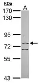Anti-CGBP antibody used in Western Blot (WB). GTX116104