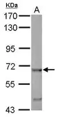 Anti-EHD4 antibody [C1C3] used in Western Blot (WB). GTX116106