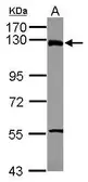 Anti-ZNF295 antibody [N1N2], N-term used in Western Blot (WB). GTX116110