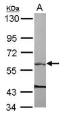 Anti-ARHGEF3 antibody [N1C1] used in Western Blot (WB). GTX116114