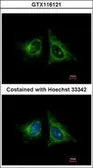 Anti-HEBP1 antibody [N1C3] used in Immunocytochemistry/ Immunofluorescence (ICC/IF). GTX116121