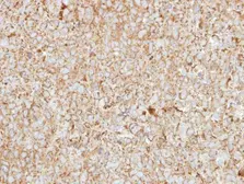 Anti-HEBP1 antibody [N1C3] used in IHC (Paraffin sections) (IHC-P). GTX116121
