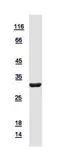 Human Geminin protein, His tag. GTX116125-pro