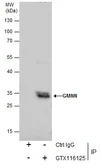 Anti-Geminin antibody used in Immunoprecipitation (IP). GTX116125