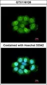 Anti-NOSIP antibody [N1C3] used in Immunocytochemistry/ Immunofluorescence (ICC/IF). GTX116126
