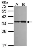 Anti-NOSIP antibody [N1C3] used in Western Blot (WB). GTX116126