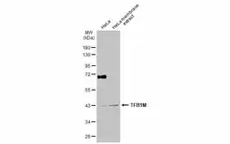 Anti-TFB1M antibody used in Western Blot (WB). GTX116131