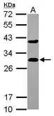 Anti-DCXR antibody [N1C3] used in Western Blot (WB). GTX116147