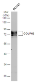 Anti-GOLPH2 antibody used in Western Blot (WB). GTX116154