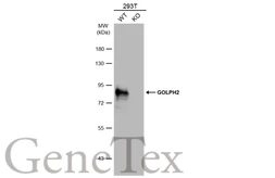 Anti-GOLPH2 antibody used in Western Blot (WB). GTX116154