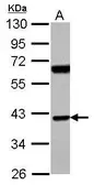 Anti-SNX7 antibody used in Western Blot (WB). GTX116160