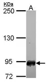 Anti-SFMBT1 antibody [N1N2], N-term used in Western Blot (WB). GTX116167