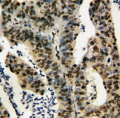 Anti-TNFAIP1 antibody used in IHC (Paraffin sections) (IHC-P). GTX11617